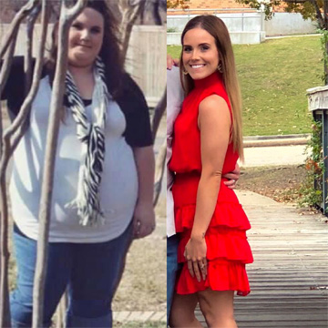 before and after woman who lost 140 pounds
