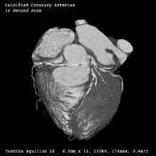 <b>New Technology Brings Improved Diagnosis of Heart Disease</b>